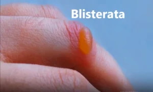 blisterata